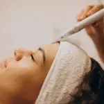 Consigli per contrastare l'acne